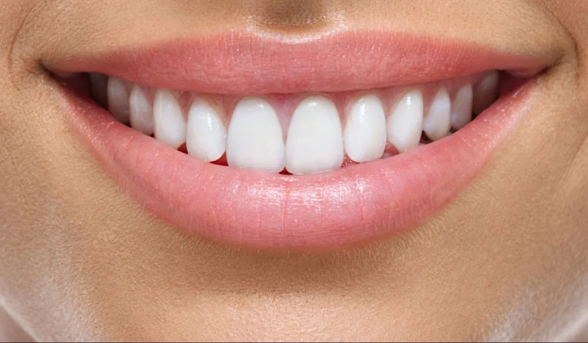 Benefícios do Clareamento Dental