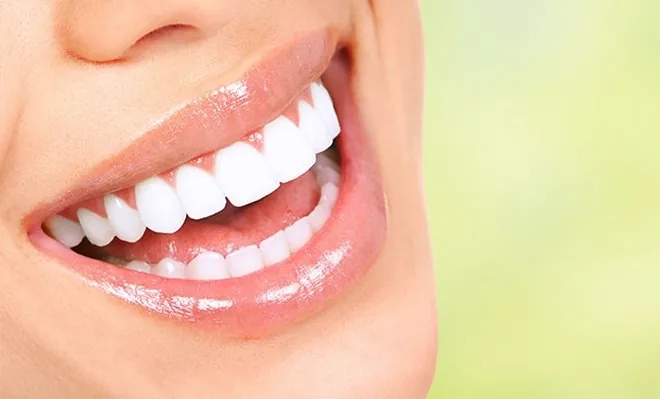 Benefícios dos Implantes Dentários